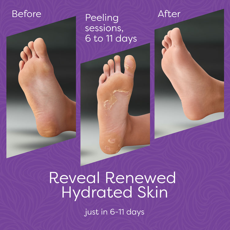 Aesta 3-in-1 Foot Peel Mask, Full-Cycle Foot Care: Revitalizing Mousse + Feet Peeling Mask + Moisturizing Cream | All-Natural Foot Peel Mask for Dry Cracked Feet | Baby Feet Foot Peel Treatment Set
